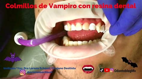 Colmillos resina Continuara.org
