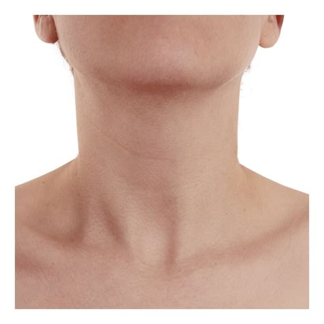 Cuello Continuara.org