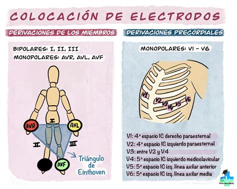 Electrodos Continuara.org
