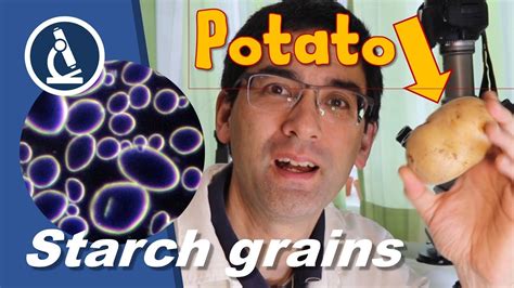 Gran potato Continuara.org