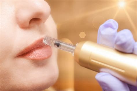 Hyaluron pen Continuara.org