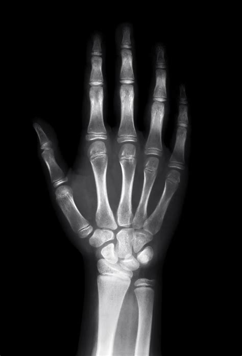 Radiografias Continuara.org