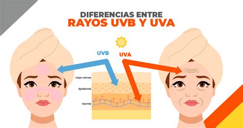 Rayo uva Continuara.org