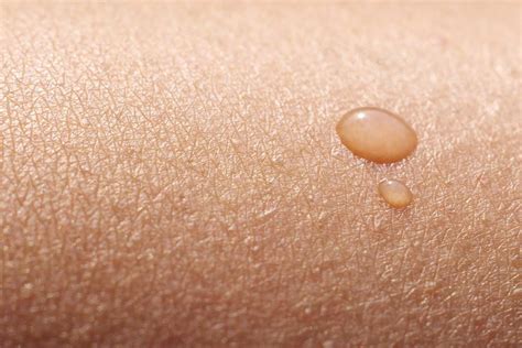Skin Continuara.org